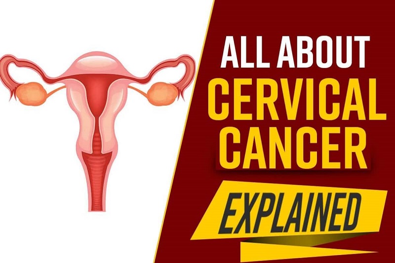 What is Cervical Cancer